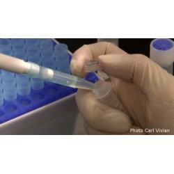 Les tests ADNs et leurs utilisations