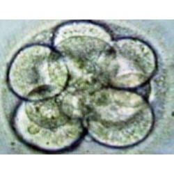 Le statut de l'embryon humain
