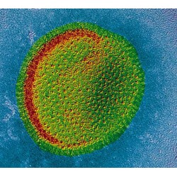 L’Origine des Virus et l’Apparition de la Vie Terrestre