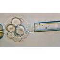 Les enjeux de la révision des lois de bioéthique en 2011