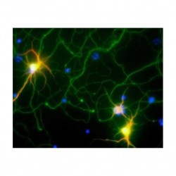 Interactions entre les virus et le cerveau