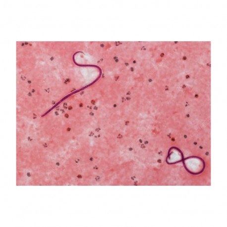 Infections parasitaires, faut-il aimer nos ennemis ?