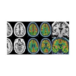 La neuro-imagerie