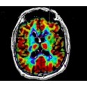 Cerveau, pensée et conscience